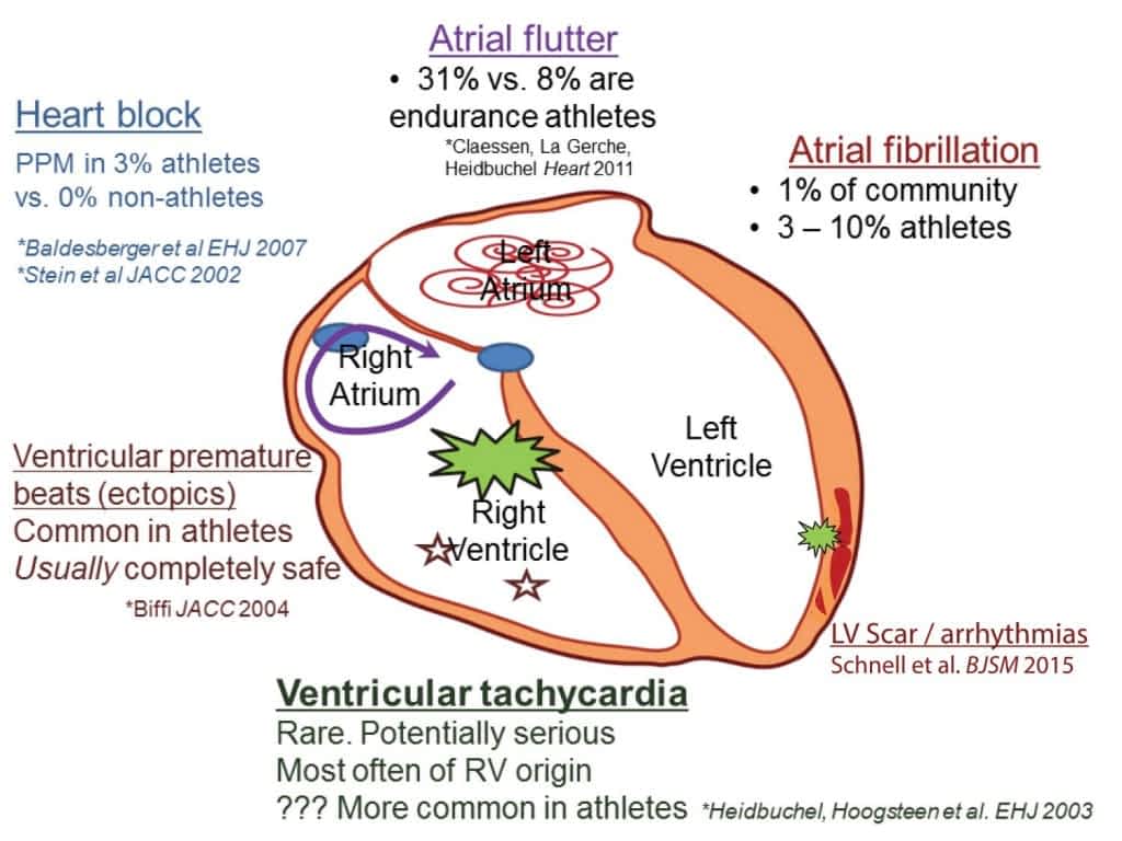 Cardiac1b